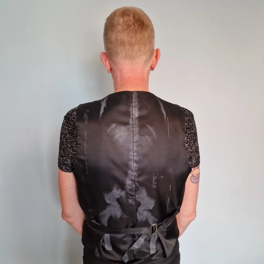 Person with back to camera showing x-ray print.